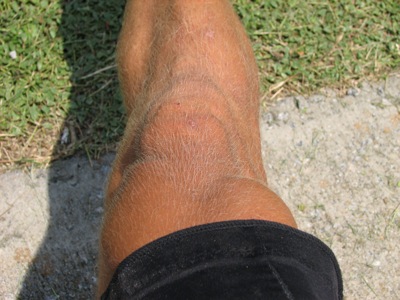 Starting to look like Hulk...